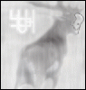Lungscollide's picture